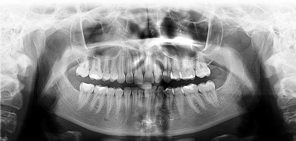 Clasificarea problemelor ortodontice